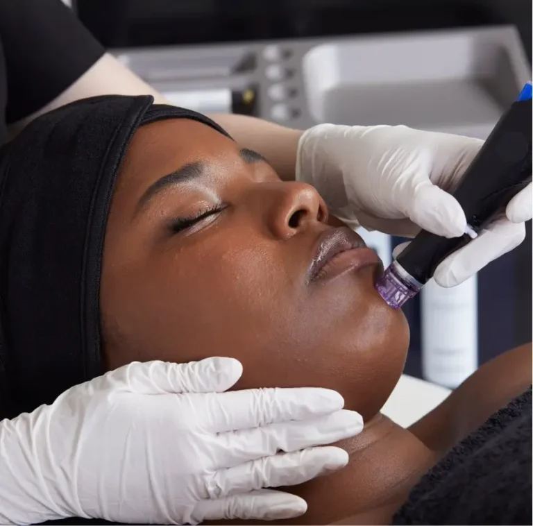 Lady Getting Hydrafacial Therapy at Embrace Wellness in Bismarck, ND
