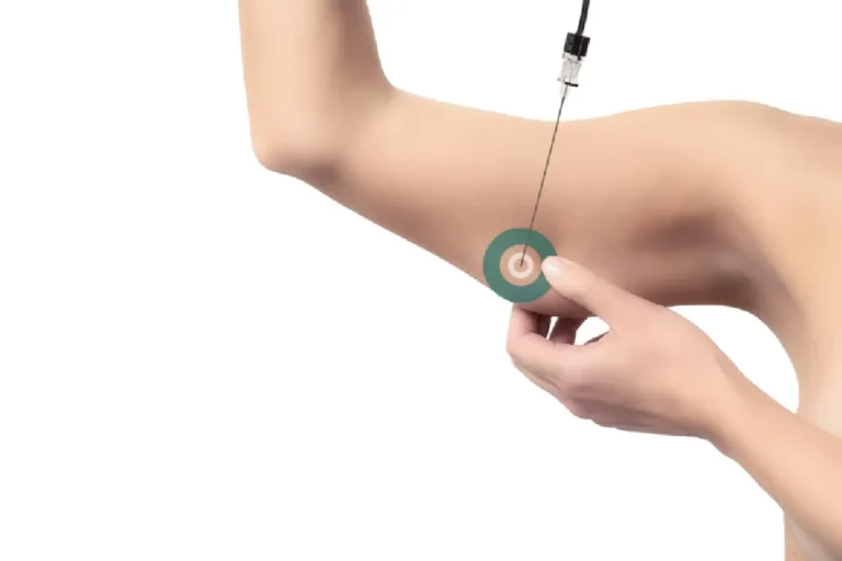 Attiva Skin Tightening Treatment in Bismarck, ND | Embrace Wellness