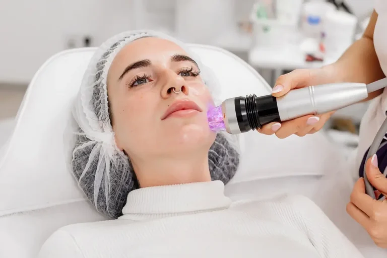 Woman Receiving RF Microneedling Treatment in Bismarck, ND | Embrace Wellness