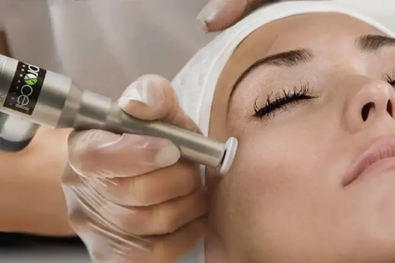 Women Receiving Microchanneling Treatment in Bismarck, ND