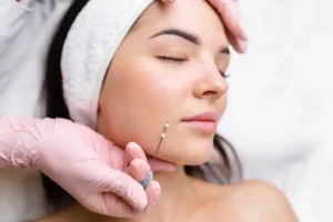 How PDO Threads Restore Jawline Definition Without Surgery