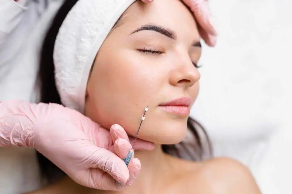 How PDO Threads Restore Jawline Definition Without Surgery