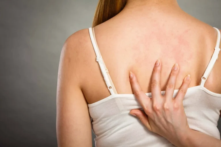 Lady showing her back seeking for Back facial Treatment at Embrace Wellness in Bismarck, ND