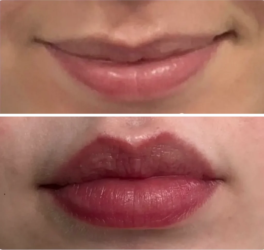 Embrace Wellness before & after