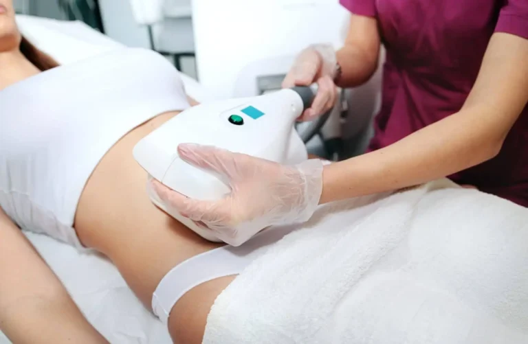 Woman Receiving Coolsculpting treatment at Embrace Wellness in Bismarck, ND