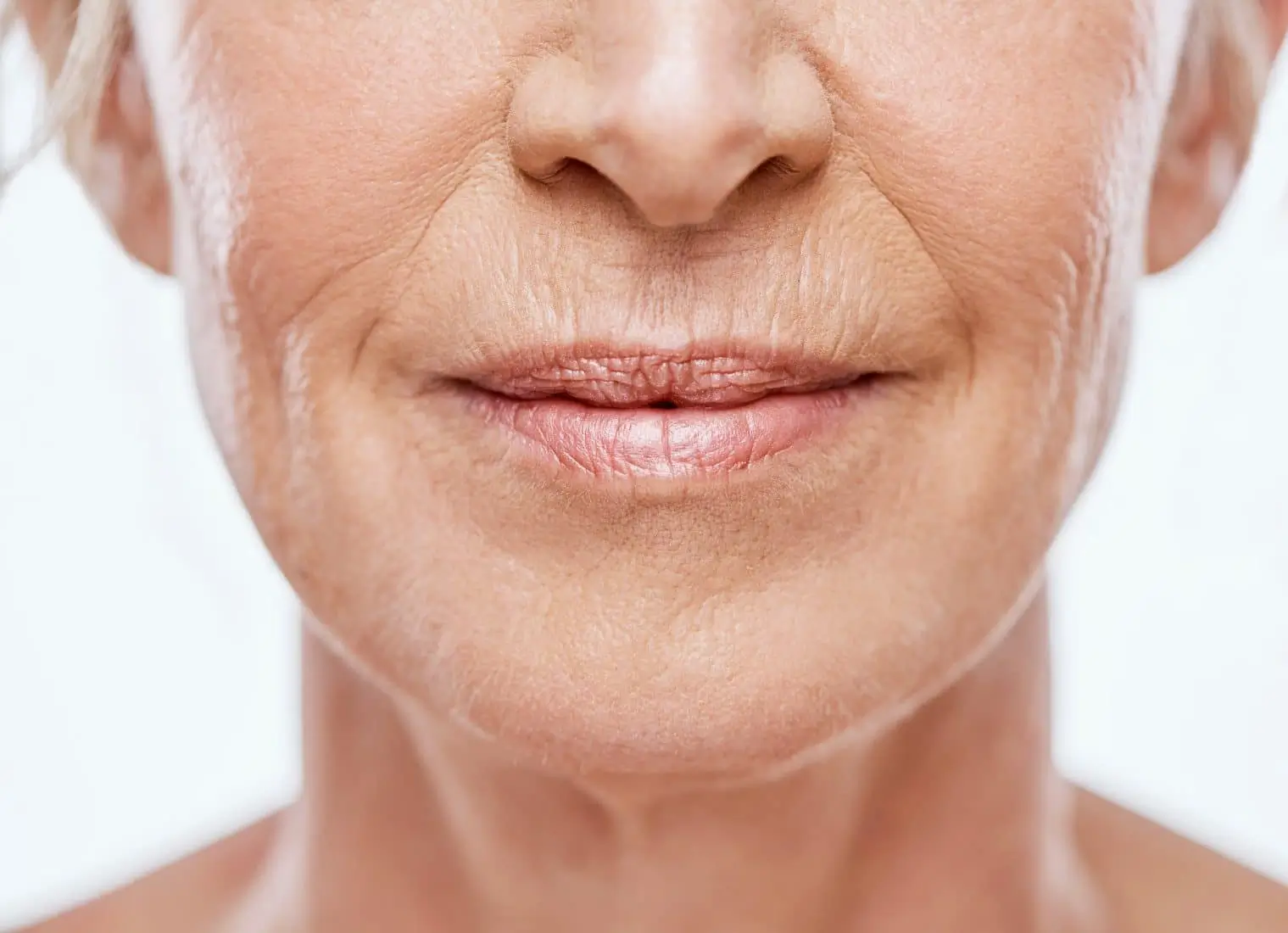 Aged woman with facial wrinkles seeking for treatment in Bismarck, ND at Embrace Wellness